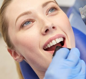 Types of Gum Disease
