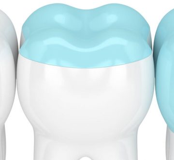 3 Reasons Why Composite Fillings Are Better Than Amalgam Fillings