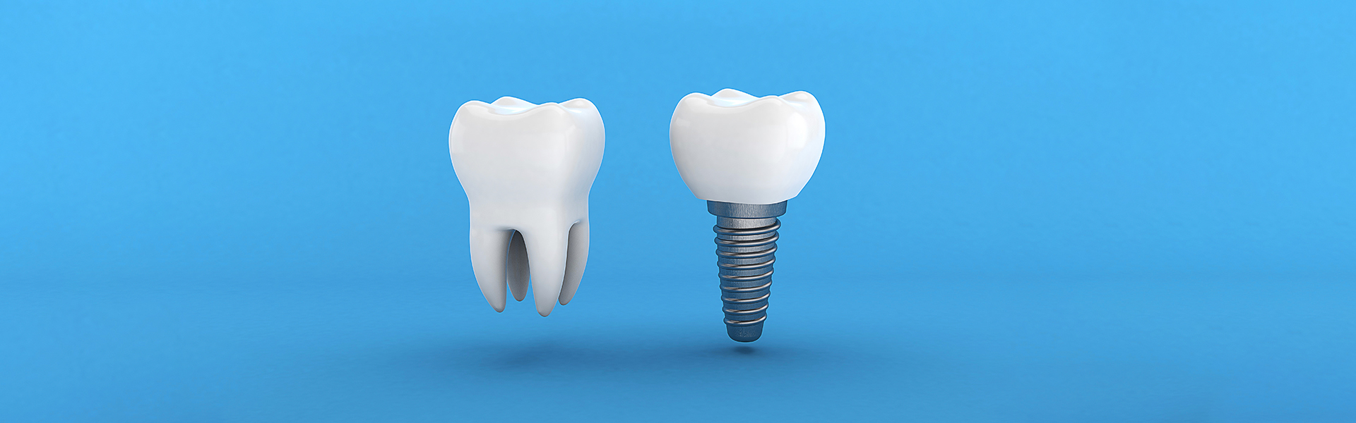 Do Dental Implants Really Work?