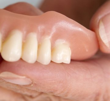 Everything You Need to Know About Dentures