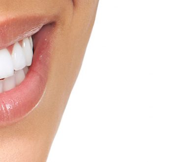 Teeth Whitening for Summer