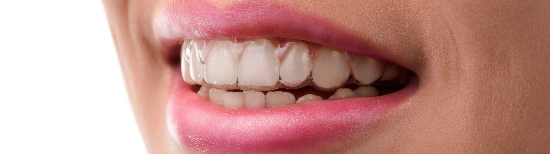 Getting the Most out of Your Invisalign Treatment