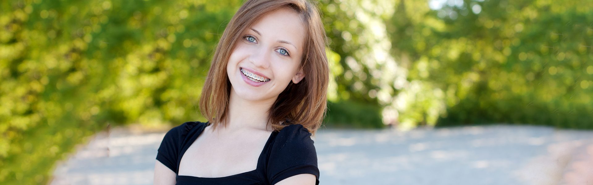 Benefits of Traditional Braces