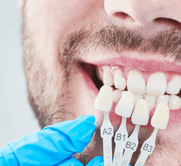The Outsider’s Guide to Porcelain Veneers.