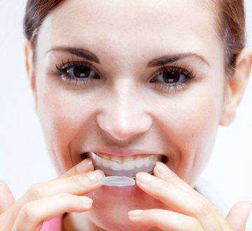 Commonly Asked Questions on Mouth Guards | Everything You Need to Know