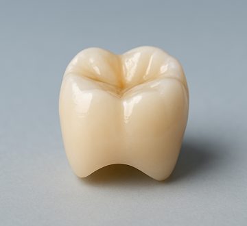 Why Choose Dental Crowns?