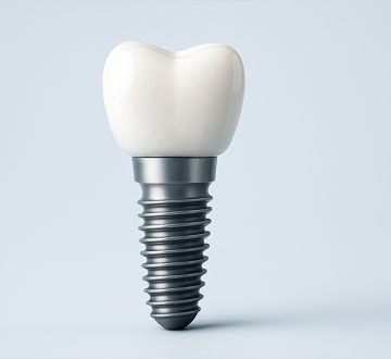 A Real Dental Implant Journey: From Consultation to Crown