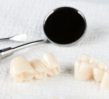 Transform Your Smile with Dental Crowns at Ramona Dentistry of Chino
